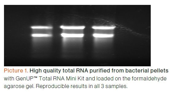 biotechrabbit GenUP™ PCR Cleanup Kit