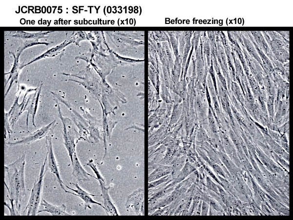 NIBN SF-TY, normal fibroblast 