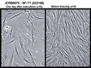 NIBN SF-TY, normal fibroblast 