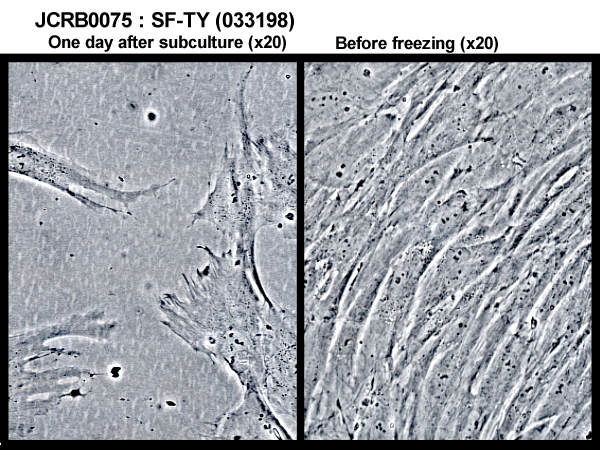 NIBN SF-TY, normal fibroblast 