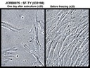 NIBN SF-TY, normal fibroblast 