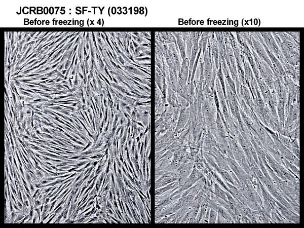 NIBN SF-TY, normal fibroblast 