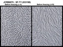 NIBN SF-TY, normal fibroblast 