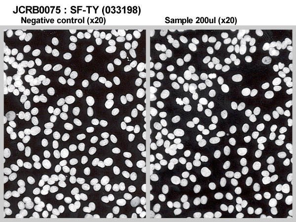 NIBN SF-TY, normal fibroblast 