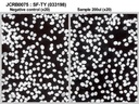 NIBN SF-TY, normal fibroblast 