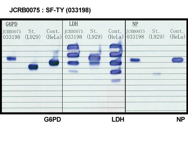 NIBN SF-TY, normal fibroblast 