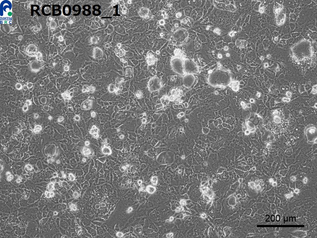RikenBRC CACO-2 Human colon carcinoma