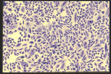 NIBN CHO-K1, Chinese hamster ovary 