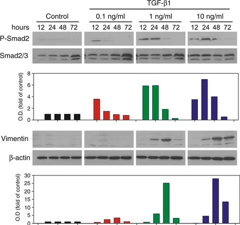 Sigma-Aldrich® Anti-Caspase 3 Antibody, 200 ug (สำเนา)