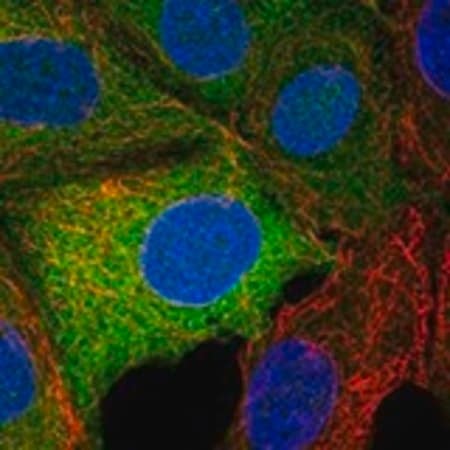 Sigma-Aldrich® Anti-TRPM7 antibody produced in rabbit