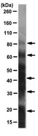 Sigma-Aldrich® Anti-TRPM7 antibody produced in rabbit