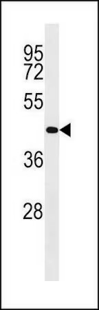 Sigma-Aldrich® Anti-TRPM7 antibody produced in rabbit