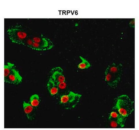 Sigma-Aldrich® Anti-TRPV6 antibody produced in rabbit,100UL
