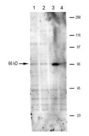 Sigma-Aldrich® Anti-TRPV6 antibody produced in rabbit,100UL