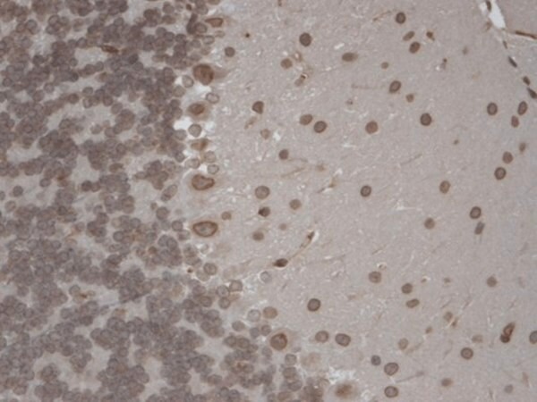 Sigma-Aldrich® Monoclonal Anti-TRPM7 antibody produced in mouse
