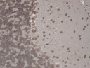 Sigma-Aldrich® Monoclonal Anti-TRPM7 antibody produced in mouse