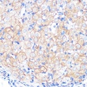 Sigma-Aldrich® Anti-Occludin antibody produced in rabbit