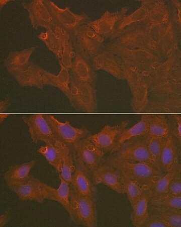 Sigma-Aldrich® Anti- Caspase-3 antibody produced in rabbit