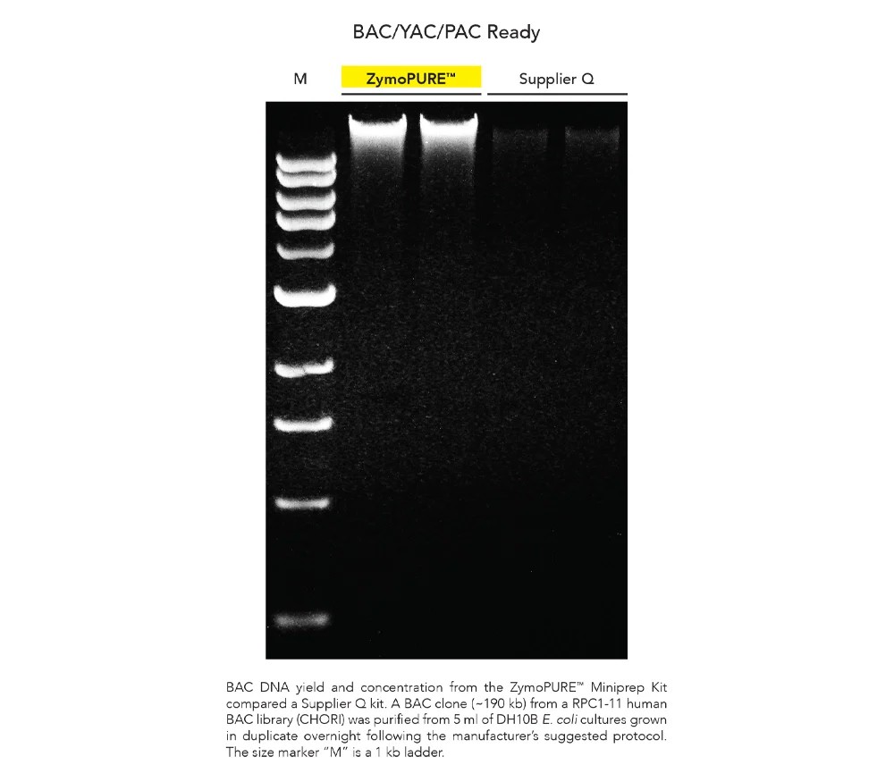 ZYMO RESEARCH® Quick-DNA/RNA MiniPrep Plus Kit (50 Preps.) (สำเนา)