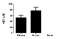 abcam ADP Assay Kit (Colorimetric/Fluorometric)