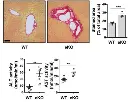 abcam Alanine Transaminase Activity Assay Kit (Colorimetric/Fluorometric)